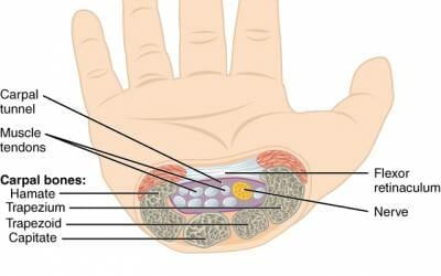 Self-Care Fixes for Carpal Tunnel and Wrist Pain